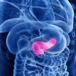 Pancreatic Cancer