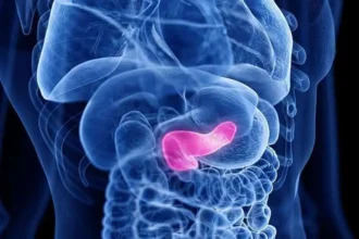 Pancreatic Cancer