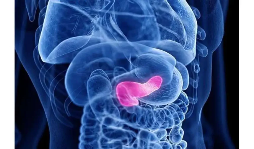 Pancreatic Cancer