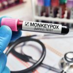 Monkeypox Canada, mpox