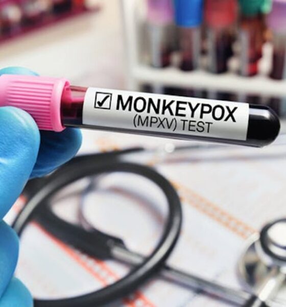 Monkeypox Canada, mpox