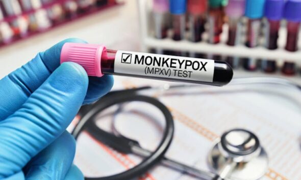 Monkeypox Canada, mpox